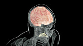 Brain and Taste Receptors, Superior View