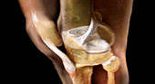 Knee Anatomy, Lateral View