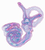 Inner ear structures, 3D MRI scan