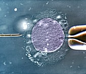 In vitro fertilisation, light micrograph