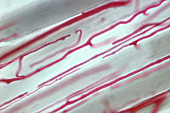 Skeletal Muscle, LM