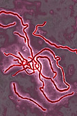 Ebola virus, TEM