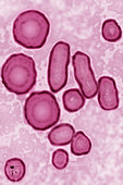 Hepatitis B virus, TEM