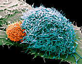 Natural killer cell and cancer cell, SEM