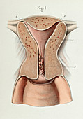 Uterine multiparous anatomy, 1866 illustration