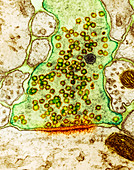 Excitatory synapse CNS, TEM