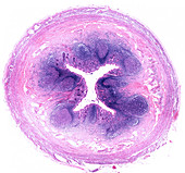 Human appendix, light micrograph