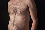 Chest of Middle Aged Man