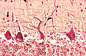 Neural tissue, Cerebellum, LM