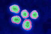 Measles Virus, TEM