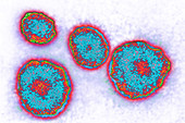 Mumps Virus, TEM