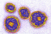 Mumps Virus, TEM