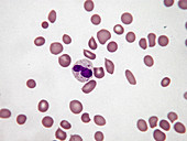 Metamyelocyte, LM