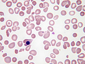 Nucleated red blood cells, LM