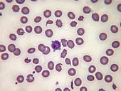 Giant platelet, LM