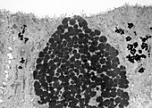 Conjunctival Epithelium, Goblet Cell and Melanosomes TEM