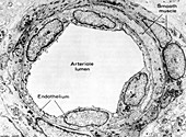 Arteriole, TEM