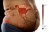 Global Obesity Rates