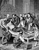 William Morton, First Use of Surgical Anesthesia, 1846