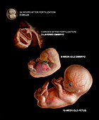 Fetus Growth
