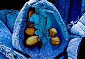 Ovule with Embryo Sac, SEM