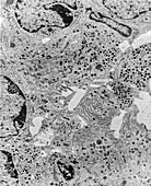 Microvilli and cilia in islet cell, TEM