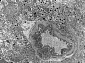 Secretion pathway of islet hormones, TEM