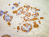 Pancreatic hormone-producing cells, LM