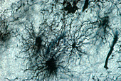Cerebrum Astrocytes, LM