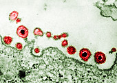 Herpes Simplex Virus, TEM