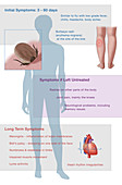 Symptoms of Lyme Disease, Illustration