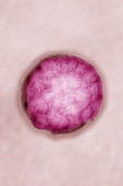 Picornavirus, TEM