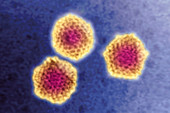 Adenovirus, TEM