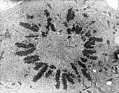 Mitosis, Metaphase Plate, TEM