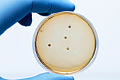 Lactobacillus bacteria colonies