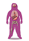 Health Effects of Childhood Obesity, Illustration