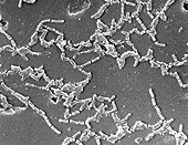 Mycobacterium chelonae Bacteria, SEM