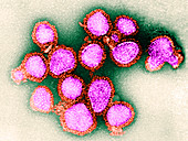 H3N2, Hong Kong Flu Virus, TEM