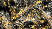 Mitochondria in breast cancer cells, fluorescent micrograph