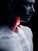 Illustration of the human thyroid gland