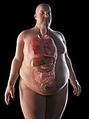 Illustration of an obese man's organs