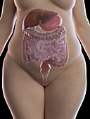 Illustration of an obese woman's digestive system