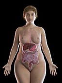 Illustration of an obese woman's digestive system