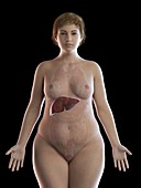 Illustration of an obese woman's liver