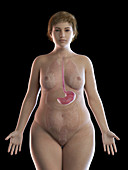 Illustration of an obese woman's stomach