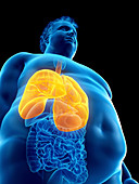 Illustration of an obese man's lungs