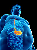 Illustration of an obese man's stomach