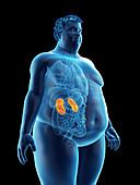 Illustration of an obese man's kidneys