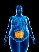 Illustration of an obese man's intestine