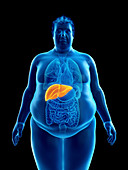 Illustration of an obese man's liver